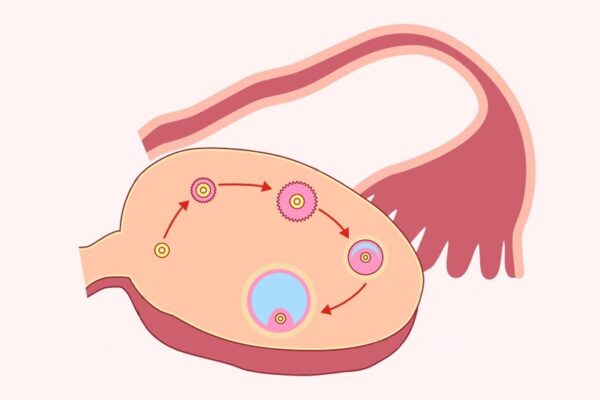 Nivel de AMH y terapia de reemplazo mitocondrial