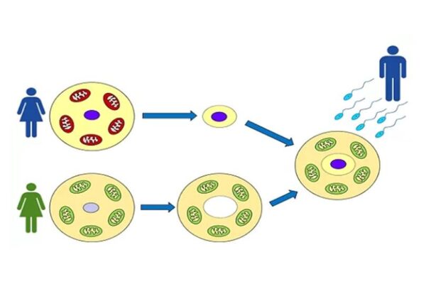 ¿Qué es un “bebé de tres padres” (MRT) en BioTexCom?
